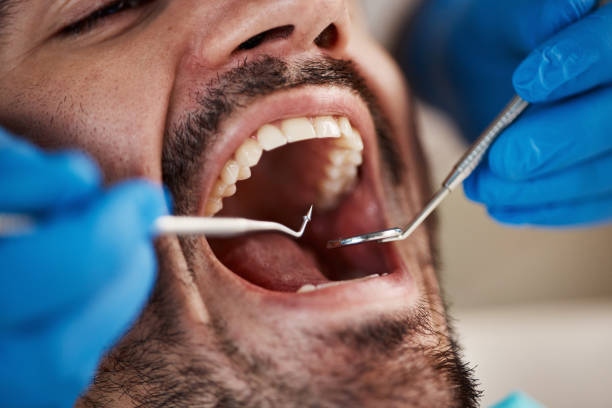 Best Emergency Dental Care for Broken or Chipped Teeth in Eleele, HI